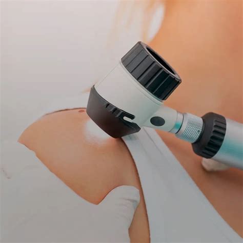 Skin Check Mole Check Dr Wang Yi Shi W Skin And Laser Clinic