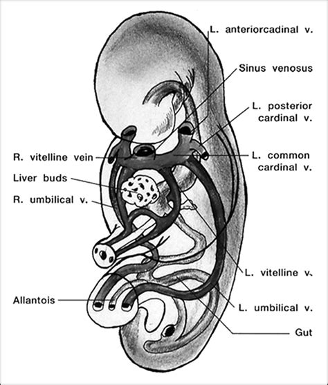 —embryonic Veins At The 4th Week Anterior Posterior Common Cardinal Download Scientific