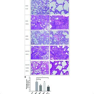 Histopathological Changes In Lung Tissues A He Staining At