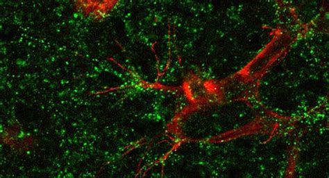 New strategy for treating common retinal diseases shows promise