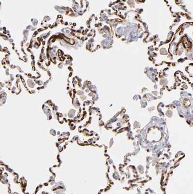 Thrombomodulin Bdca Antibody Nbp Novus Biologicals