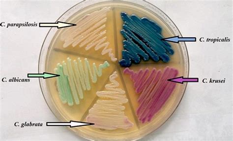 Candida glabrata- An Overview