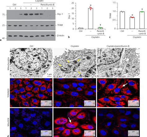 Figure From Penicilliumin B Protects Against Cisplatin Induced Renal