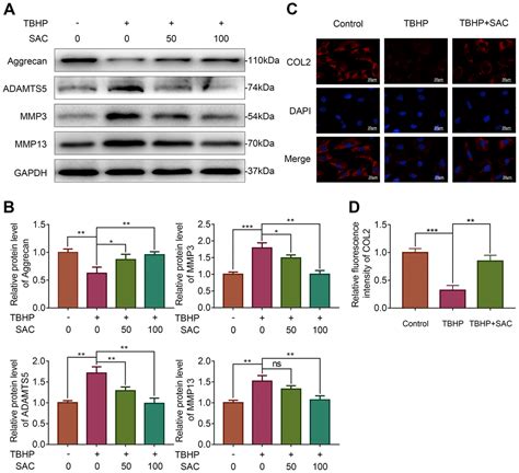 S Allyl Cysteine Reduces Osteoarthritis Pathology In The Tert Butyl