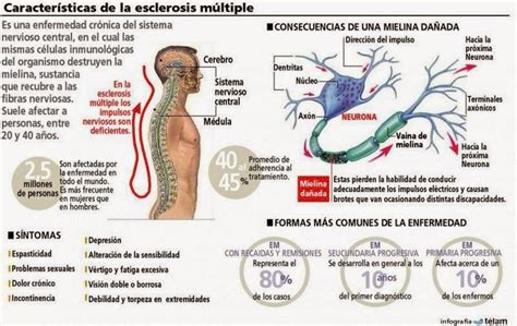 Saber Y Vivir Con Esclerosis Múltiple Pronóstico De La Em