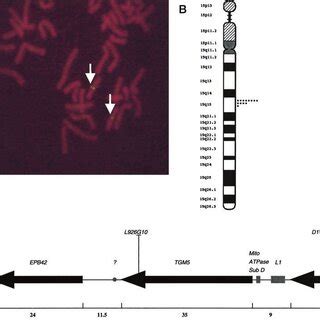 Chromosomal Localization Of The Human Tgm Gene By Fluorescence In Situ