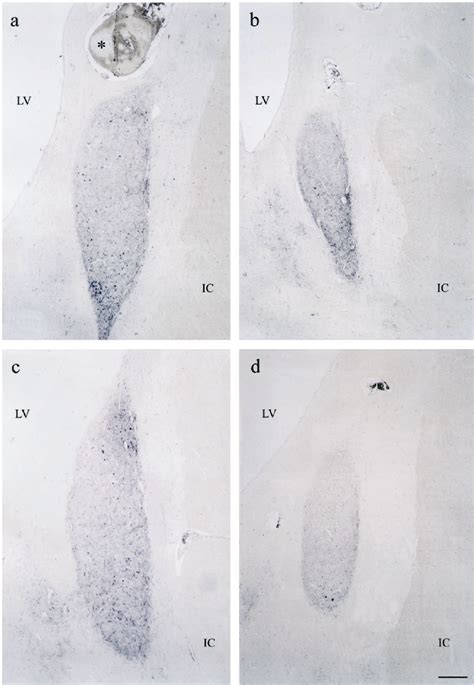 Figure From The Journal Of Clinical Endocrinology Metabolism