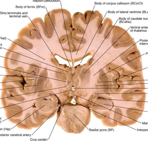 Coronal Cross Sections Flashcards Quizlet