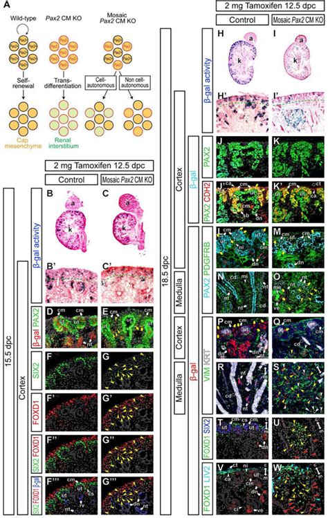 Pax2 Function In Cap Mesenchyme Cells Is Required Cell Autonomously To