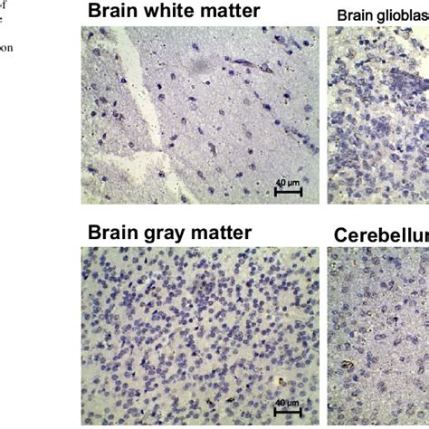 Expression Pattern Of Herv K Env Protein In The Lymphatic System And