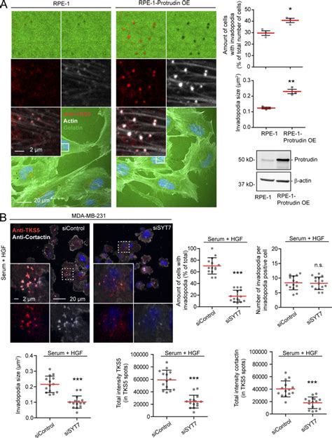 Invadopodia Formation Is Stimulated By Protrudin Overexpression And