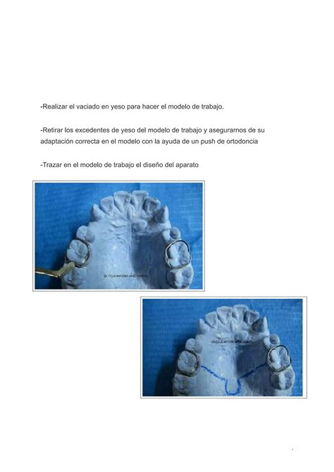 Mantenedores De Espacio Odontopediatria Pdf