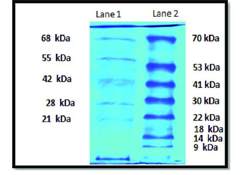 Sds Page Gel Analysis Of Phage Proteins Lane Shows Five Bands And