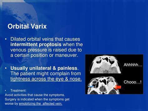 The Orbit. - ppt download