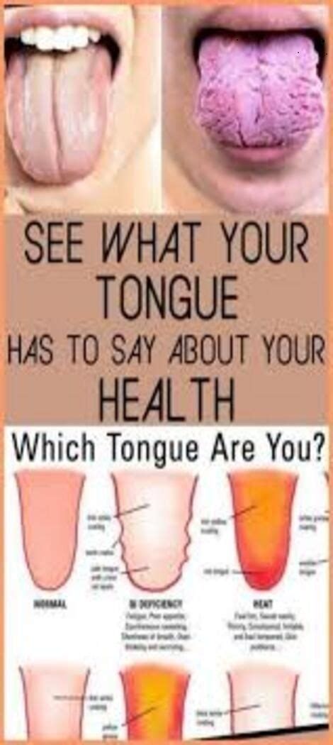 What Your Tongue Is Trying To Tell You About Your Health In