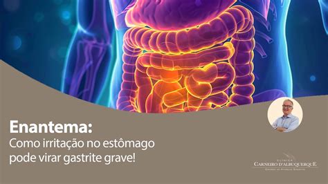 O Que É Enantema Leve - Enantema: Como irritação no estômago pode virar gastrite grave! | Prof ...