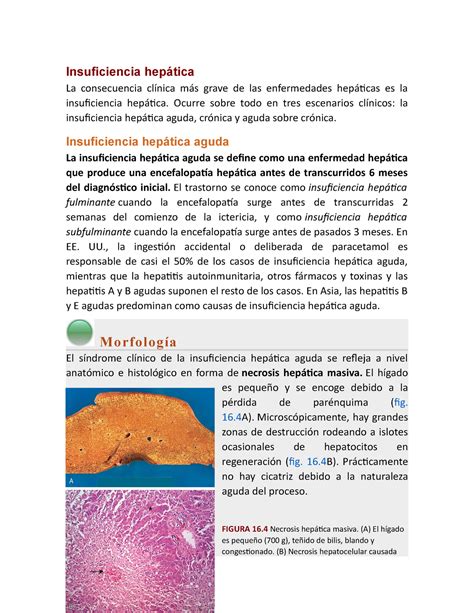 Ins Hep Tica Ensayo Insuficiencia Hep Tica La Consecuencia Cl Nica