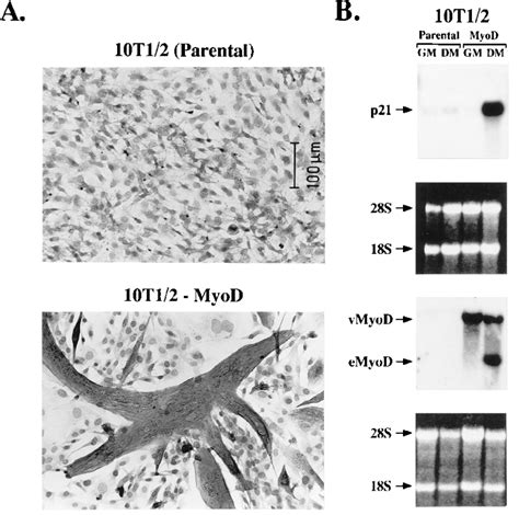 Myod Dependent Induction Of P21 Upon Myogenic Commitment And Terminal