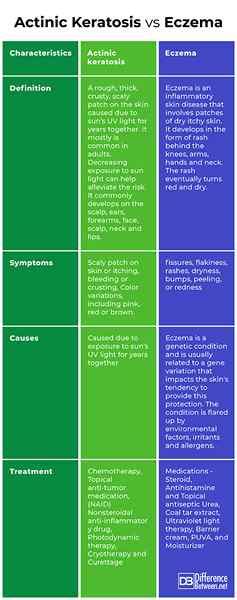 Diferencia Entre La Queratosis Act Nica Y El Eccema Diffexpert