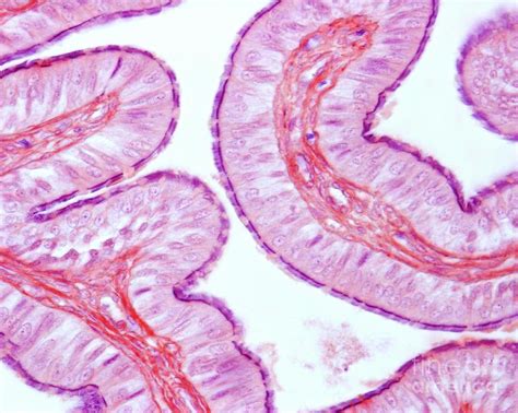 Fallopian Tube Ciliated Epithelium 1 Photograph By Science Photo