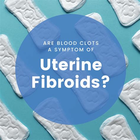 Are Blood Clots a Symptom of Fibroids? | New York City | 1 Fibroid Center