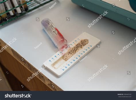 Capillary Tube Hematocrit Tube Hematology Laboratory Stock Photo