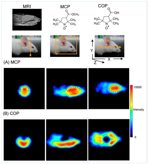 Brain Redox Imaging Using In Vivo Electron Paramagnetic Resonance