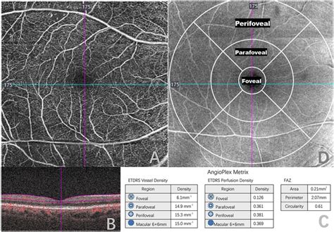 Quantitative Measurement Of Optical Coherence Tomography Angiography