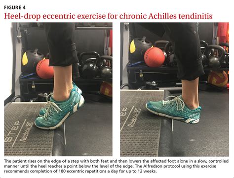 Consider These Exercises For Chronic Musculoskeletal Conditions