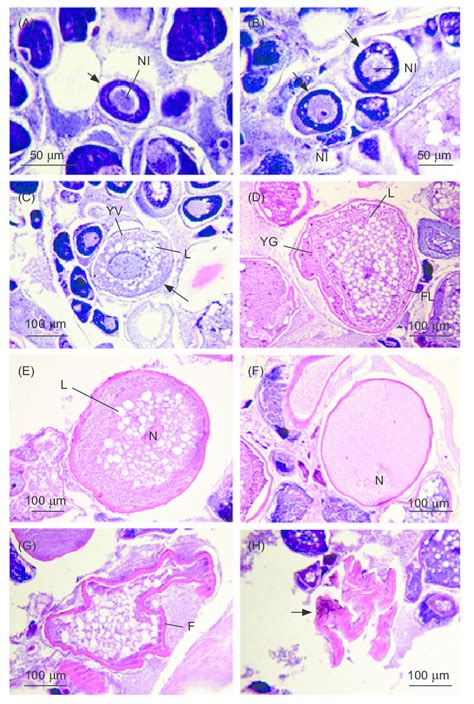 Seven Developmental Stages Of Oocytes In The Ovary Of Chaetodontoplus