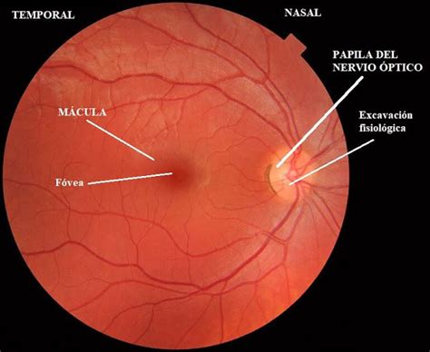 Exploración de fondo de ojo Clinica Oftalmológica Halcón