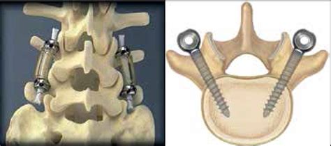 Scielo Brasil Clinical Evaluation Of Patients Undergoing Dynamic