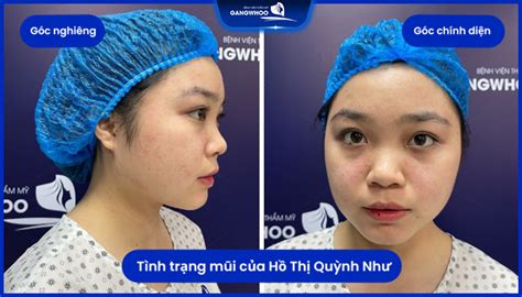 C N Ng H Th Qu Nh Nh H A Hot Girl H N Qu C Sau Khi N Ng M I C U Tr C