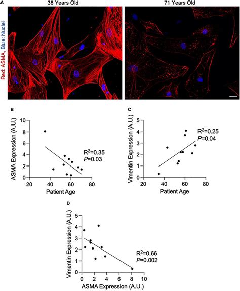 Alpha Smooth Muscle Actin Asma Decreases And Vimentin Increases With Download Scientific