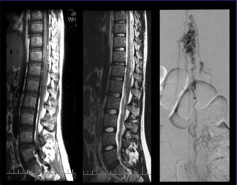 Question 118 MRI Online