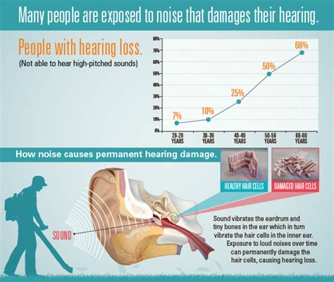 Hearing Loss At 20 Cdc Says Its More Common Than You Think Nbc News