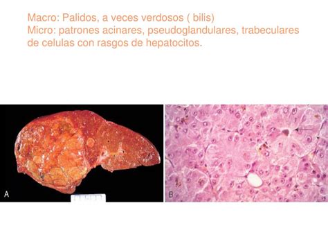 PPT Patologias Hepaticas GENERALIDADES Ubicacion Peso Division