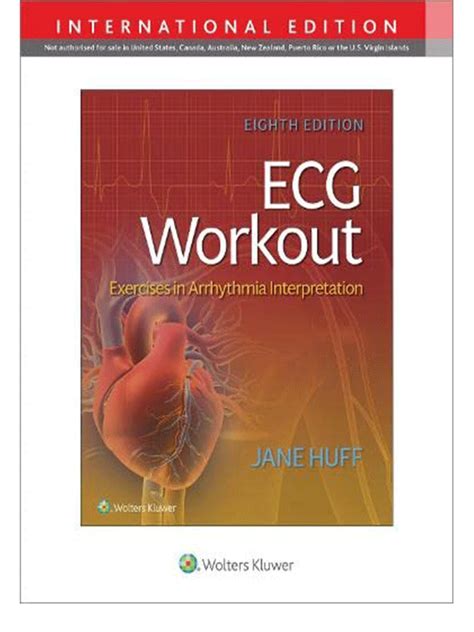 Ecg Workout Exercises In Arrythmia Interpretation Th Edition