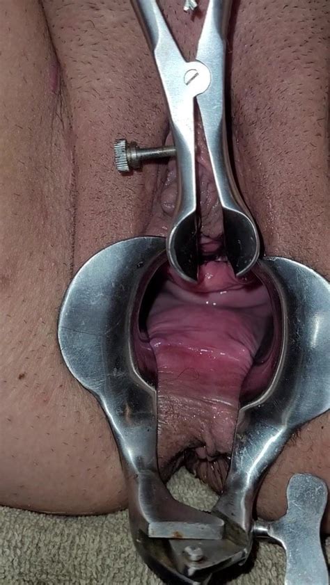 Speculum Opening Her Peehole Free Porn Video B XHamster XHamster