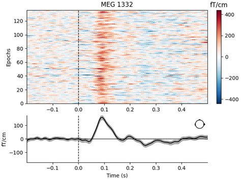 Overview Of Meg Eeg Analysis With Mne Python Mne Documentation