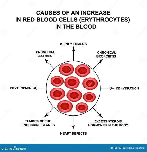 Causes of Increased Red Blood Cells. Cells Erythrocytes. Hemoglobin ...