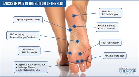 Foot Pain Chart Metro Tulsa Foot Ankle