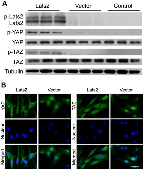 A Lats Mediated Enhanced Phosphorylation Of Yap And Taz Whole Cell