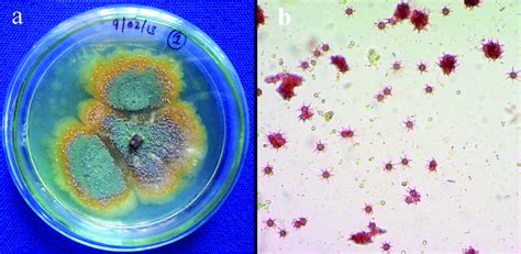 A Colony Morphology Of Endosymbiotic Emericella Variecolor Clb On