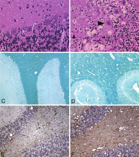 A And B H E Stained Sections Of The Cerebellar Cortex Original