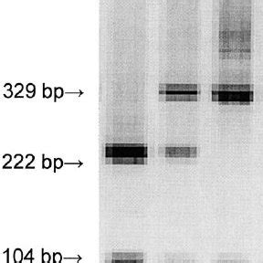 Agarose Gel Electrophoresis Of Gstm Gstt And Globin Pcr Product