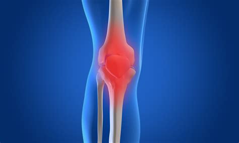 Global Knee Cartilage Repair Market $5.9 Billion by 2031