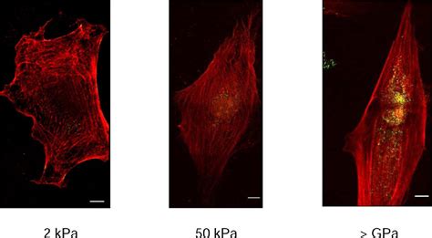 Figure 3 From The Role Of Extracellular Matrix Stiffness In Regulating Cytoskeletal Remodeling