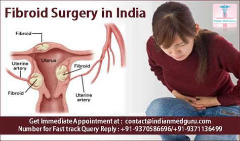 Pocket Friendly Options For Advanced Uterine Fibroid Surgery India