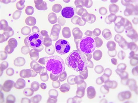 Best Eosinophil Stock Photos, Pictures & Royalty-Free Images - iStock